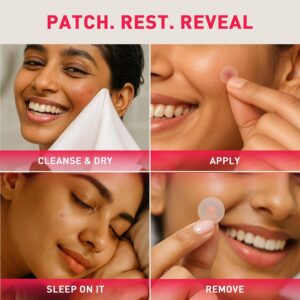acne patches Bangladesh