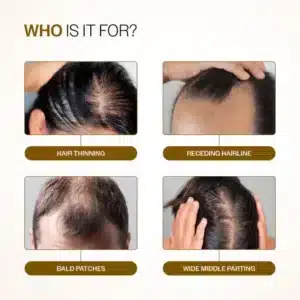 Bare Anatomy Hair Growth Serum Roll-On with Redensyl and Anagain