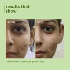 Plum Green Tea Pore Cleansing Face Wash _ HER CARE Bangladesh
